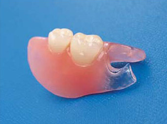 レイニング樹脂Ｎによる部分入れ歯