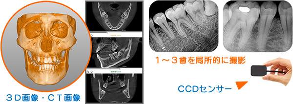 歯科用CT・デジタルレントゲン撮影システム、CT・3D・デンタル画像