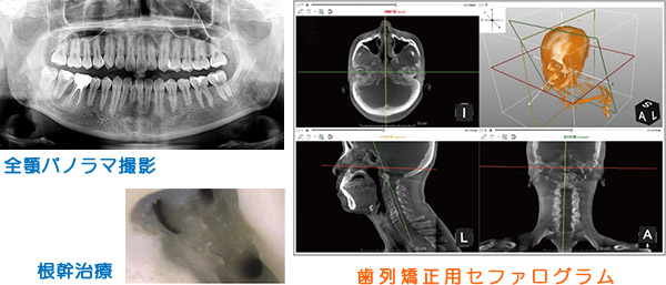 歯科用CT・デジタルレントゲン撮影システム、全顎パノラマ・根幹治療用CT・歯列矯正用セファログラム画像