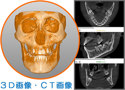 歯科用CT・デジタルレントゲン撮影システム、CT画像、3D画像