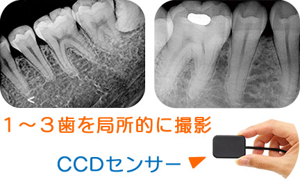 歯科用CT・デジタルレントゲン撮影システム、デンタル画像