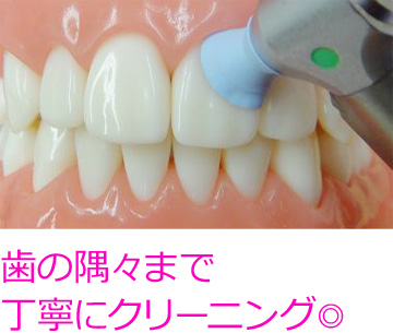 予防歯科ならＰＭＴＣ！ そのくらいお勧めです！