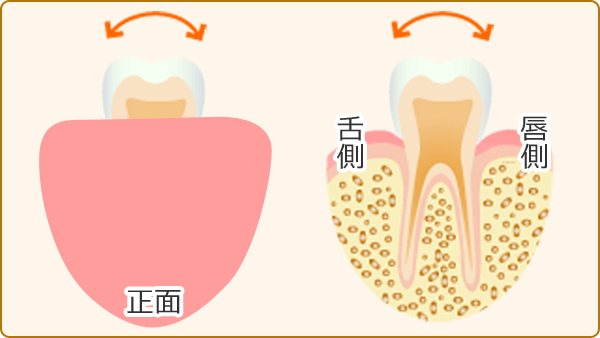 歯周基本検査：歯の動揺度検査