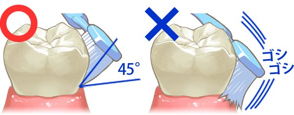 ＴＢＩ：歯磨きの説明･練習
